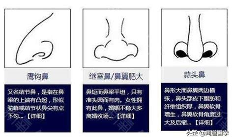 福鼻 面相|鼻相分析10款｜鼻樑有節及橫紋、豬膽鼻、鼻頭下垂代表甚 